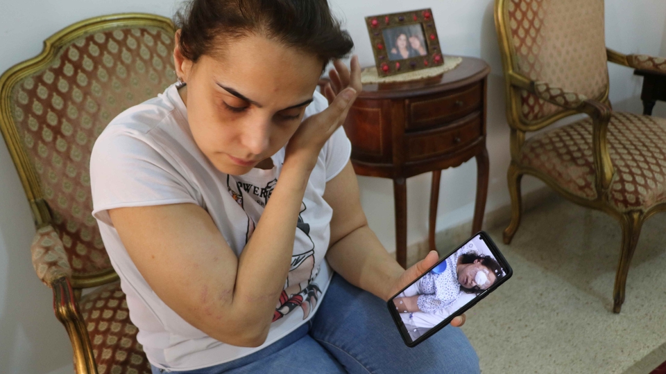 Mirna sits in armchair, scars visible on arms and forehead. She motions with right hand to head injury; holds phone in her left hand, displaying a photo of her in the hospital.